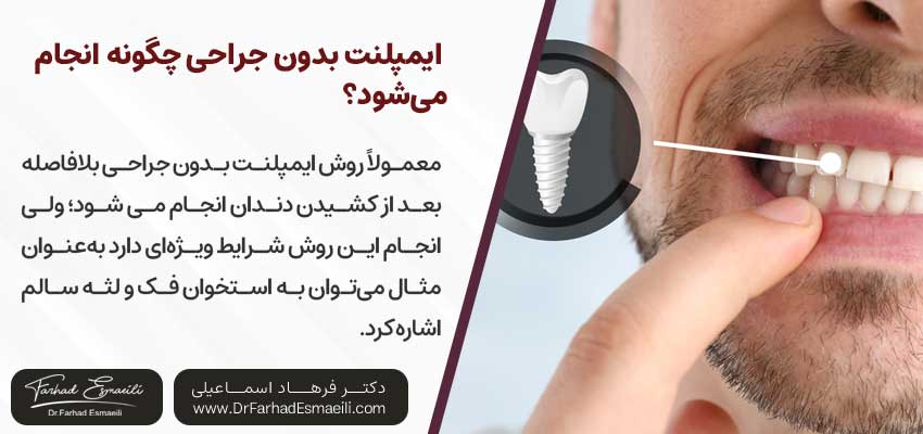 ایمپلنت بدون جراحی چگونه انجام می‌شود؟ | دکتر فرهاد اسماعیلی متخصص ایمپلنت اصفهان