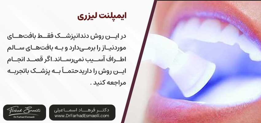 ایمپلنت لیزری | دکتر فرهاد اسماعیلی متخصص ایمپلنت اصفهان