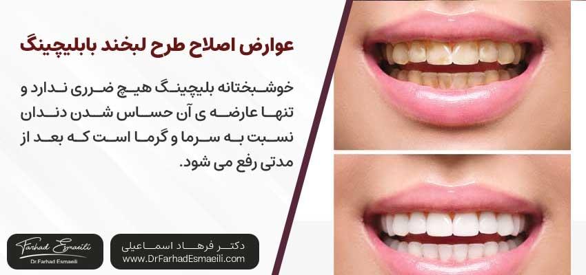 عوارض اصلاح طرح لبخند با بلیچینگ