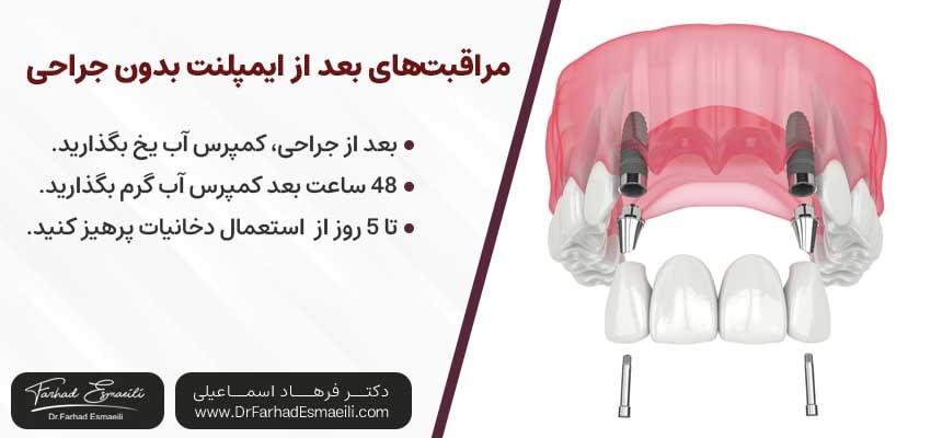 مراقبتهای لازم بعد از ایمپلنت بدون جراحی در اصفهان | دکتر فرهاد اسماعیلی متخصص ایمپلنت اصفهان