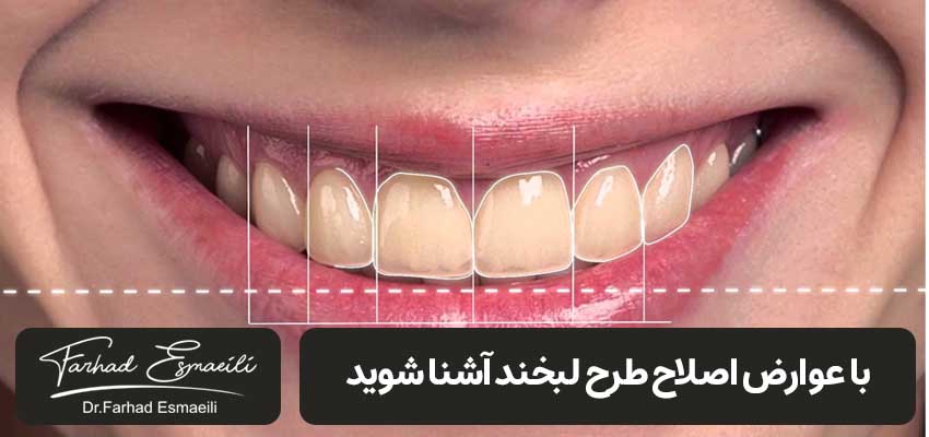 complications repair smile design