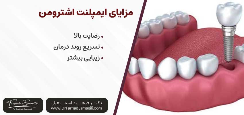 مزایای ایمپلنت اشترومن یکی از انواع ایمپلنت سوئیسی | دکتر فرهاد اسماعیلی متخصص ایمپلنت اصفهان