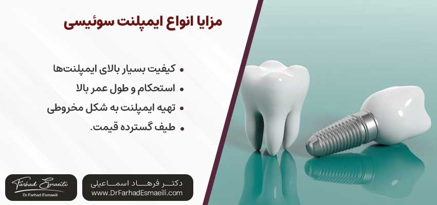 مزایای ایمپلنت سوئیسی | دکتر فرهاد اسماعیلی متخصص ایمپلنت اصفهان