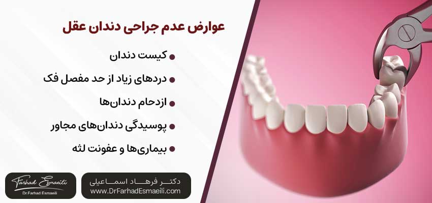 عوارض عدم جراحی دندان عقل | دکتر فرهاد اسماعیلی متخصص ایمپلنت در اصفهان