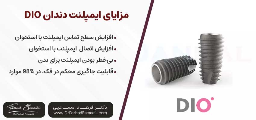 برند DIO یکی از انواع ایمپلنت های کره ای| دکتر فرهاد اسماعیلی متخصص ایمپلنت اصفهان