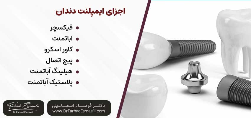 اجزای ایمپلنت دندان | دکتر فرهاد اسماعیلی متخصص ایمپلنت اصفهان