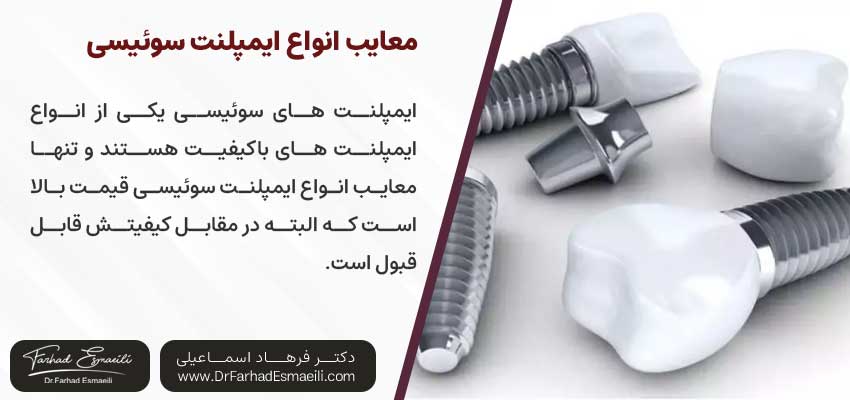 معایب ایمپلنت سوئیسی | دکتر فرهاد اسماعیلی متخصص ایمپلنت اصفهان