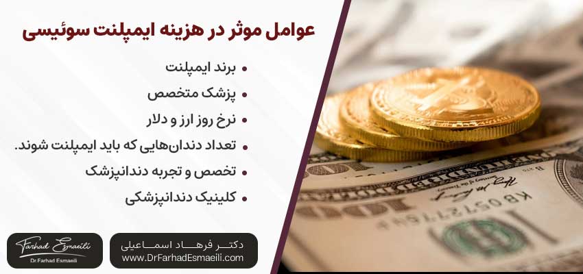 هزینه ایمپلنت سوئیسی | دکتر فرهاد اسماعیلی متخصص ایمپلنت اصفهان