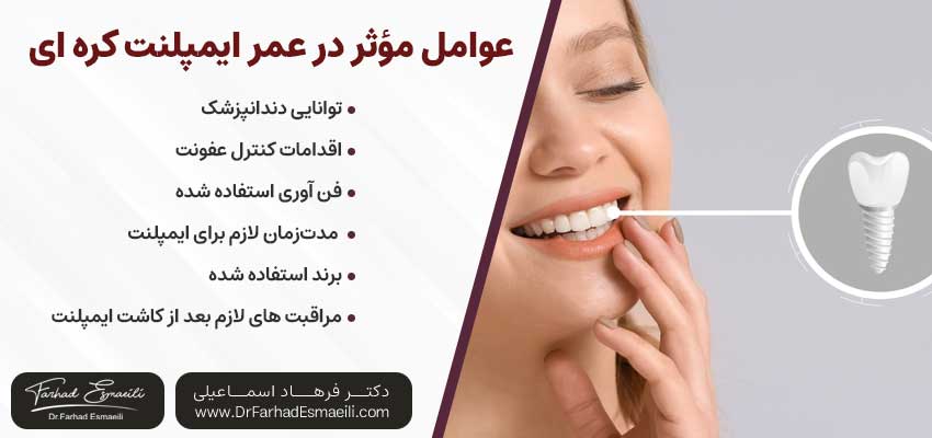 عمر ایمپلنت کرهای چقدر است؟| دکتر فرهاد اسماعیلی متخصص ایمپلنت اصفهان