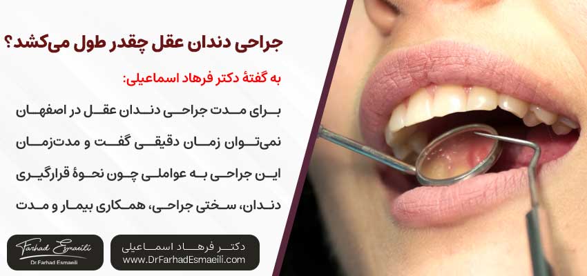 جراحی دندان عقل چقدر طول می‌کشد؟ | دکتر فرهاد اسماعیلی متخصص ایمپلنت در اصفهان