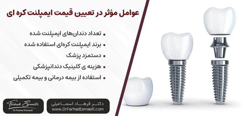 هزینه ایمپلنت کره ای | دکتر فرهاد اسماعیلی متخصص ایمپلنت اصفهان