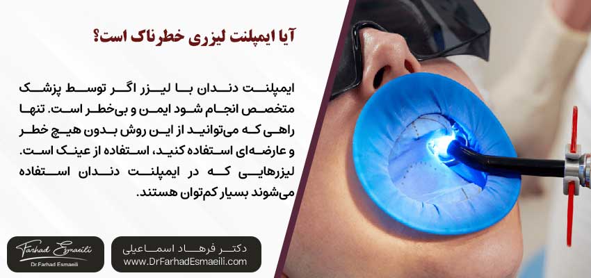 آیا ایمپلنت لیزری خطرناک است؟| دکتر فرهاد اسماعیلی متخصص ایمپلنت در اصفهان