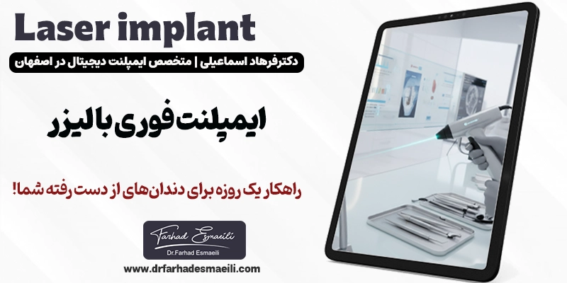 ایمپلنت فوری با لیزر: راهکار یک روزه برای دندان‌های از دست رفته شما!