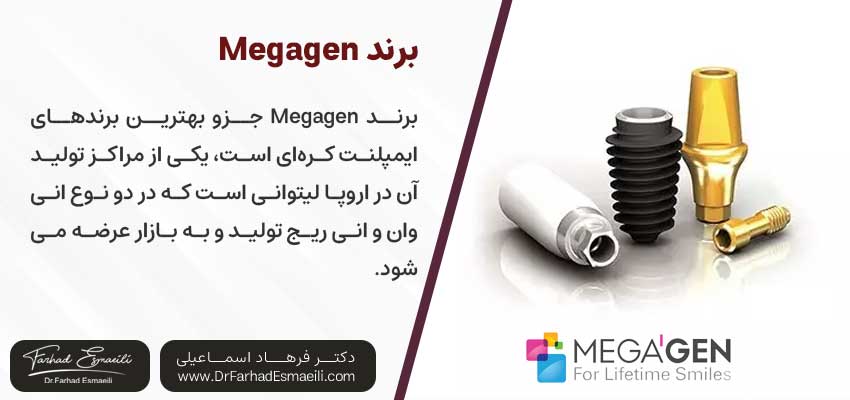 برند Megagen یکی از انواع ایمپلنت های کره ای| دکتر فرهاد اسماعیلی متخصص ایمپلنت اصفهان