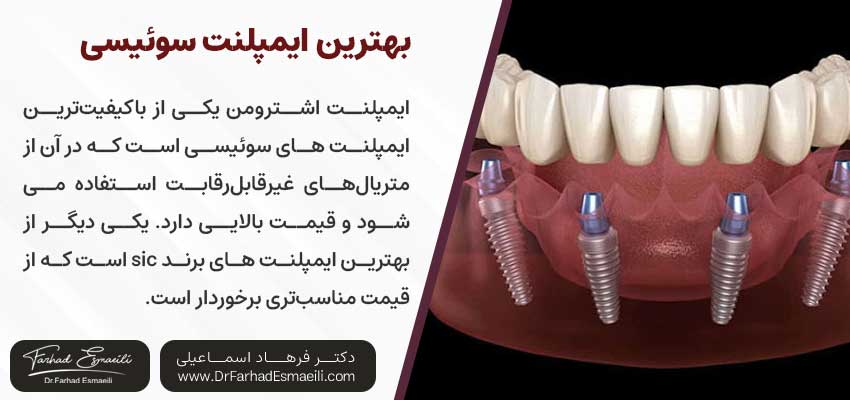 بهترین ایمپلنت سوئیسی | دکتر فرهاد اسماعیلی متخصص ایمپلنت اصفهان