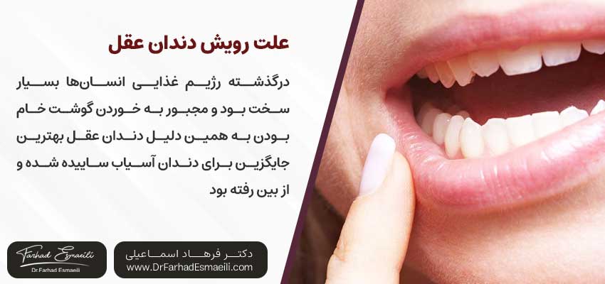 علت رویش دندان عقل | دکتر فرهاد اسماعیلی متخصص ایمپلنت در اصفهان