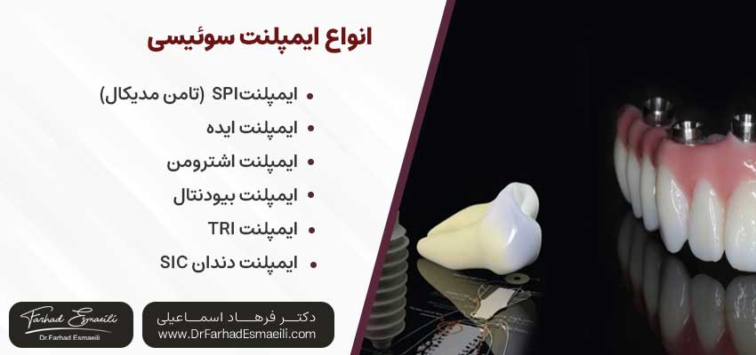 انواع ایمپلنت سوئیسی | دکتر فرهاد اسماعیلی متخصص ایمپلنت اصفهان