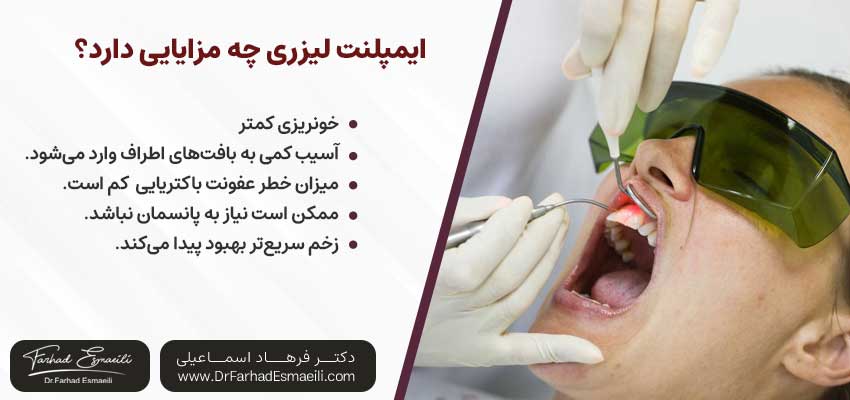 ایمپلنت لیزری چه مزایایی دارد؟ | دکتر فرهاد اسماعیلی متخصص ایمپلنت در اصفهان
