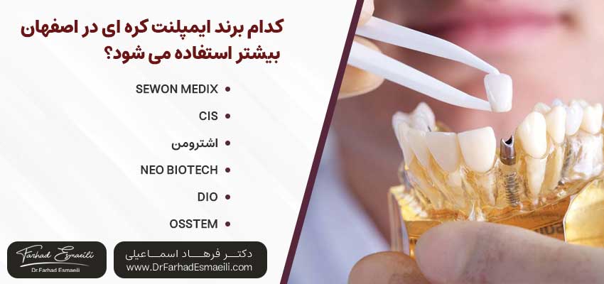 کدام برند ایمپلنت کره ای بیشتر استفاده می شود؟ | دکتر فرهاد اسماعیلی متخصص ایمپلنت اصفهان