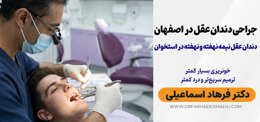 جراحی دندان عقل در اصفهان | تجربهای آرام و بدون درد با دکتر فرهاد اسماعیلی
