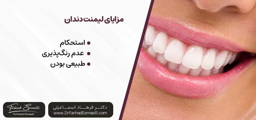 مزایای لیمنت دندان | دکتر فرهاد اسماعیلی متخصص ایمپلنت در اصفهان 