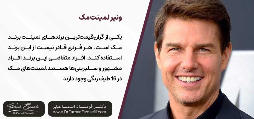 ونیر لمینت مک | دکتر فرهاد اسماعیلی متخصص ایمپلنت در اصفهان