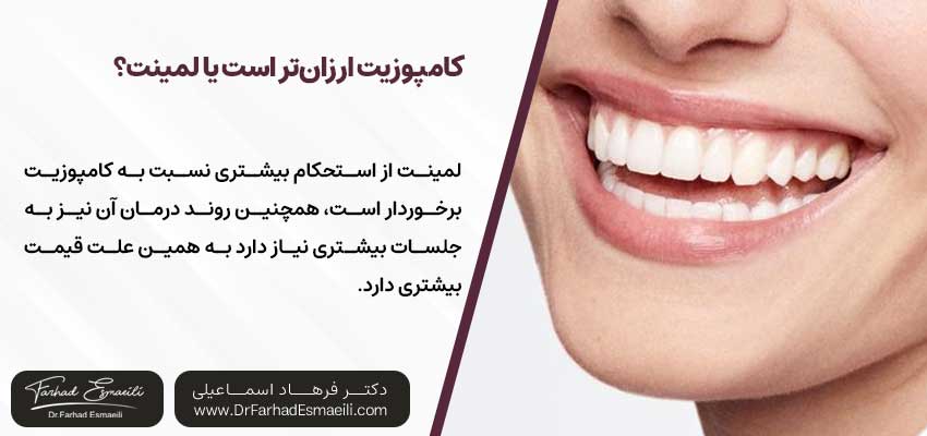 کامپوزیت ارزانتر است یا لمینت؟ - کامپوزیت ارزانتر است یا لمینت دکتر فرهاد اسماعیلی متخصص دندانپزشکی زیبایی در اصفهان