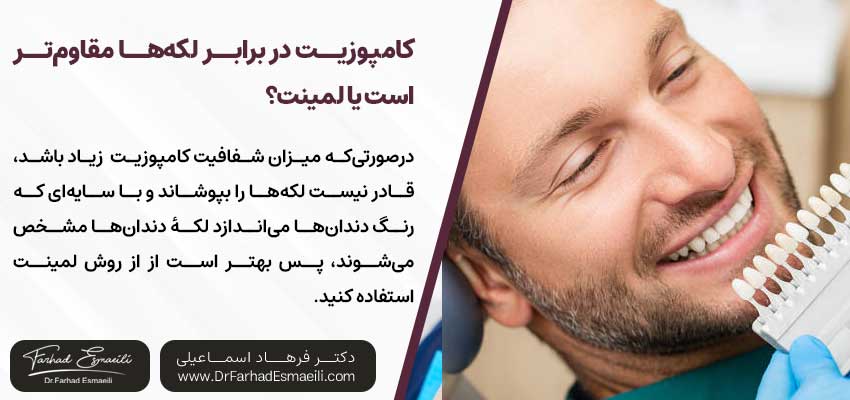 کامپوزیت در برابر لکه‌ها مقاوم‌تر است یا لمینت؟ | دکتر فرهاد اسماعیلی متخصص ایمپلنت در اصفهان 