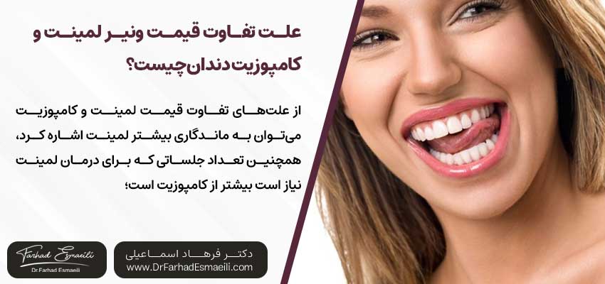 علت تفاوت قیمت ونیر لمینت و کامپوزیت دندان چیست؟ | دکتر فرهاد اسماعیلی متخصص ایمپلنت در اصفهان