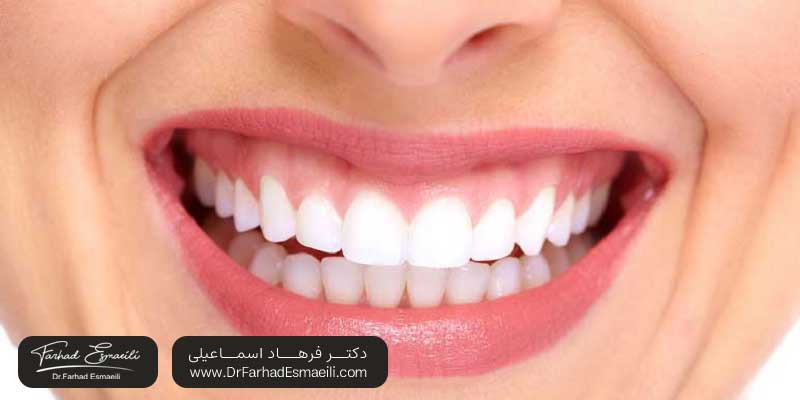 انواع اوردنچر | دکتر فرهاد اسماعیلی متخصص ایمپلنت در اصفهان