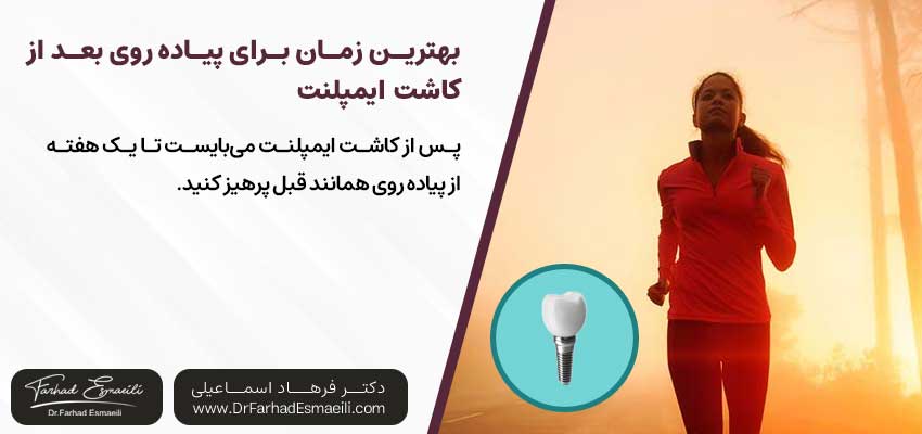 مراقبت‌های حین ورزش پس از کاشت ایمپلنت | دکتر فرهاد اسماعیلی متخصص ایمپلنت در اصفهان