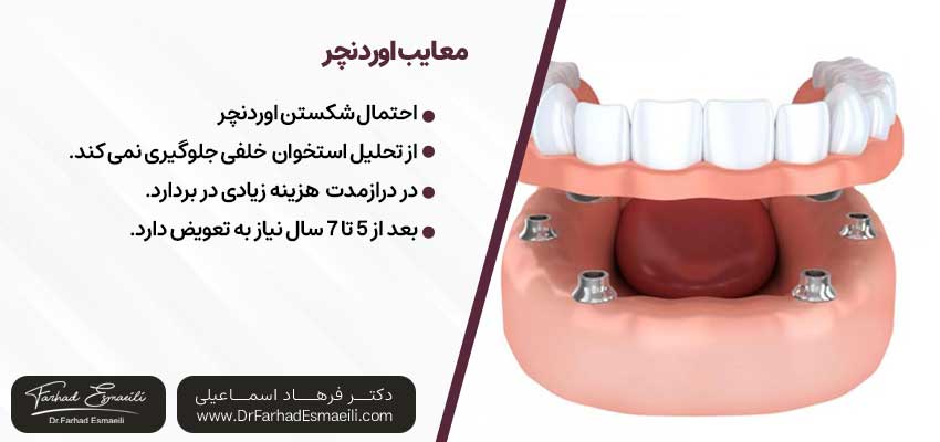 معایب اوردنچر | دکتر فرهاد اسماعیلی متخصص ایمپلنت در اصفهان