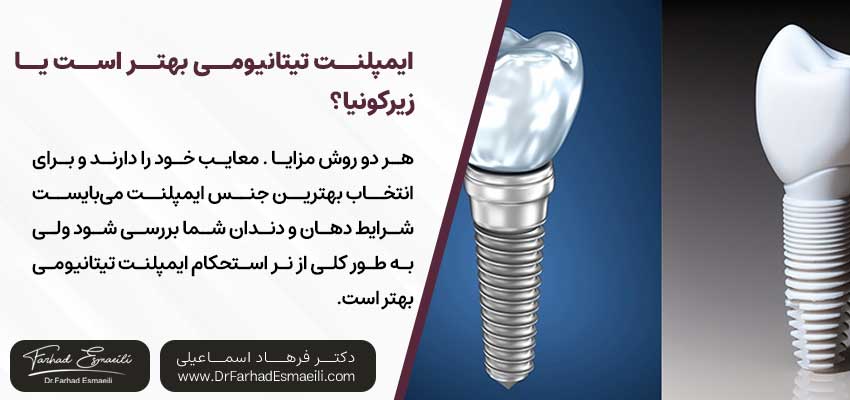 ایمپلنت تیتانیومی بهتر است یا زیرکونیا؟ | دکتر فرهاد اسماعیلی متخصص ایمپلنت در اصفهان