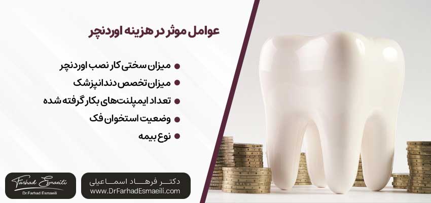 هزینه اوردنچر | دکتر فرهاد اسماعیلی متخصص ایمپلنت در اصفهان