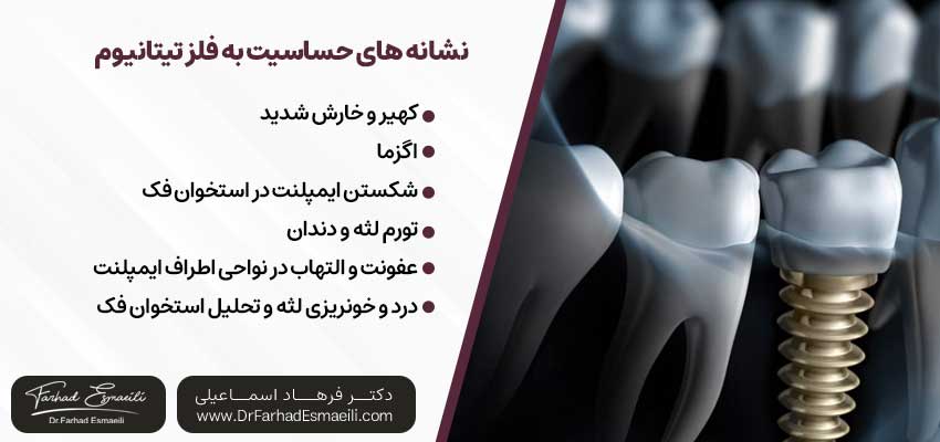 نشانه های حساسیت به فلز تیتانیوم | دکتر فرهاد اسماعیلی متخصص ایمپلنت در اصفهان