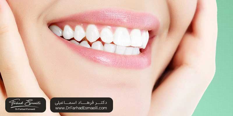ایمپلنت بهتر است یا اوردنچر؟ | دکتر فرهاد اسماعیلی متخصص ایمپلنت در اصفهان