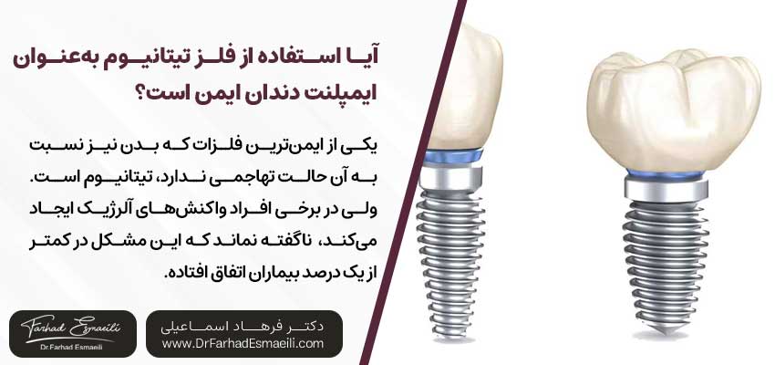 آیا استفاده از فلز تیتانیوم به‌عنوان ایمپلنت دندان ایمن است؟ | دکتر فرهاد اسماعیلی متخصص ایمپلنت در اصفهان