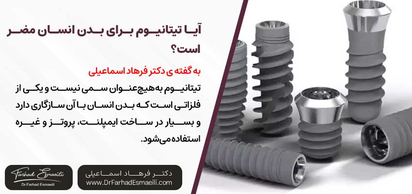 آیا تیتانیوم برای بدن انسان مضر است؟ | دکتر فرهاد اسماعیلی متخصص ایمپلنت در اصفهان
