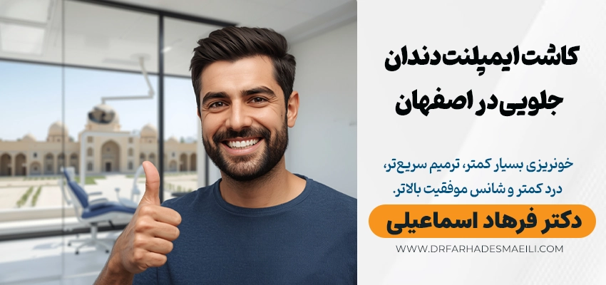 کاشت ایمپلنت دندان جلو در اصفهان