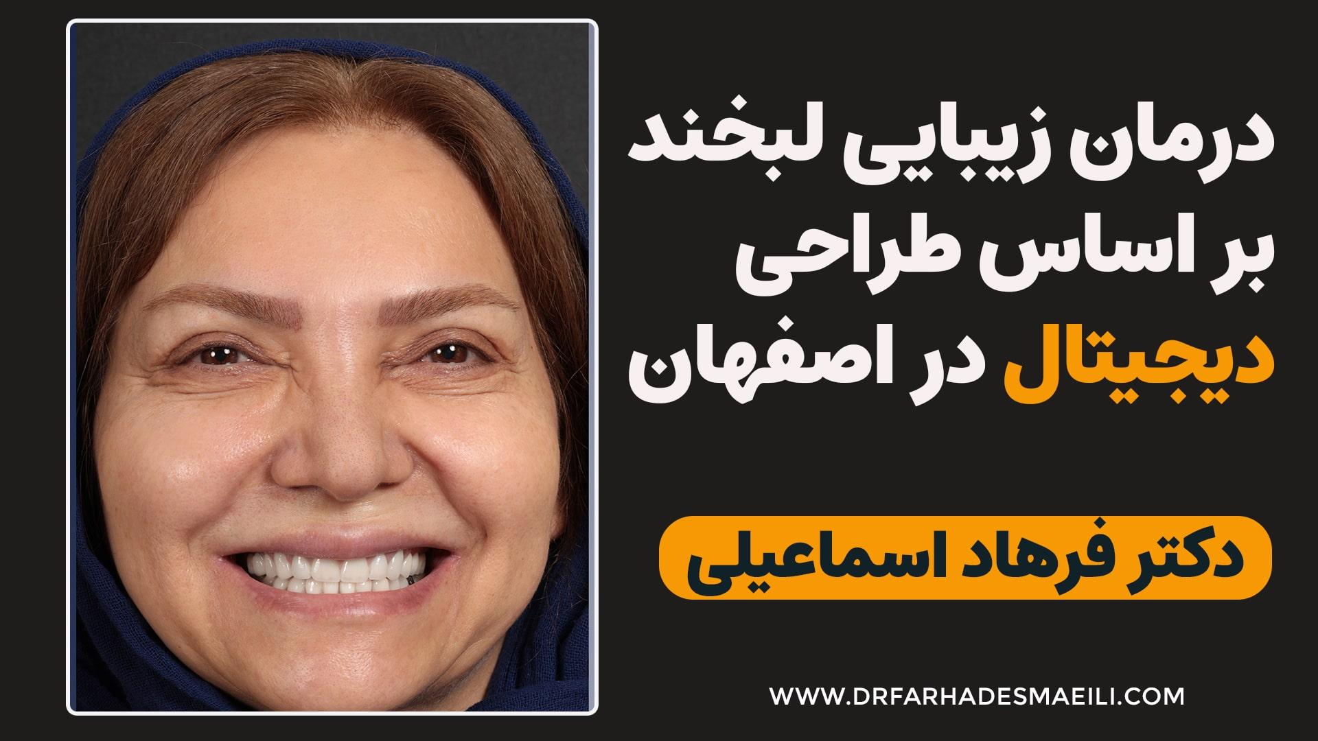 درمان زیبایی لبخند بر اساس طراحی دیجیتال در اصفهان