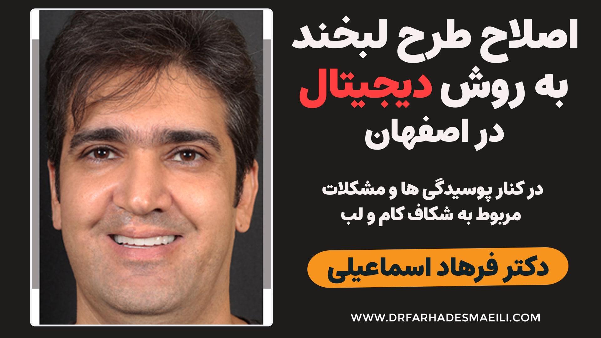 اصلاح طرح لبخند به روش دیجیتال در کنار پوسیدگی و مشکلات مربوط به شکاف کام و لب