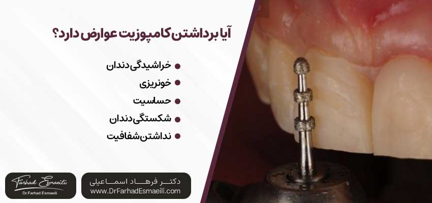 آیا برداشتن کامپوزیت عوارض دارد؟
