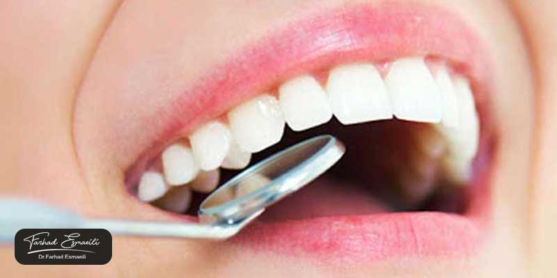 حذف کامپوزیت با ورق‌های سمباده‌ای