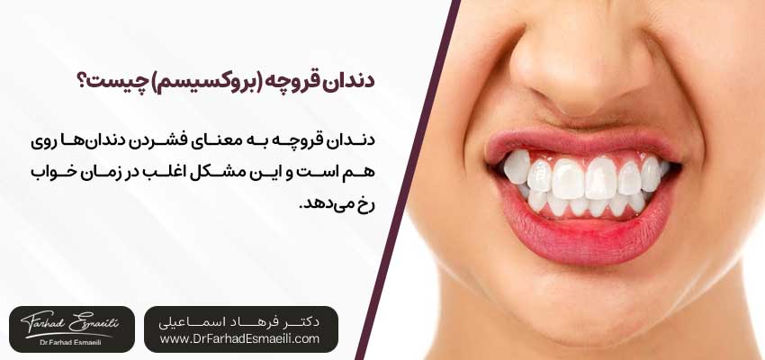 دندان قروچه (بروکسیسم) چیست؟