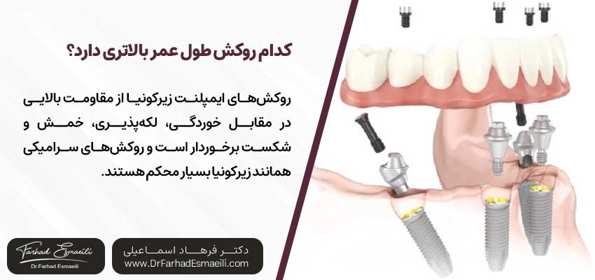 کدام روکشی طول عمر بالاتری دارد؟