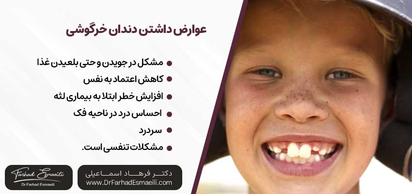 آیا داشتن دندان خرگوشی عوارض دارد؟