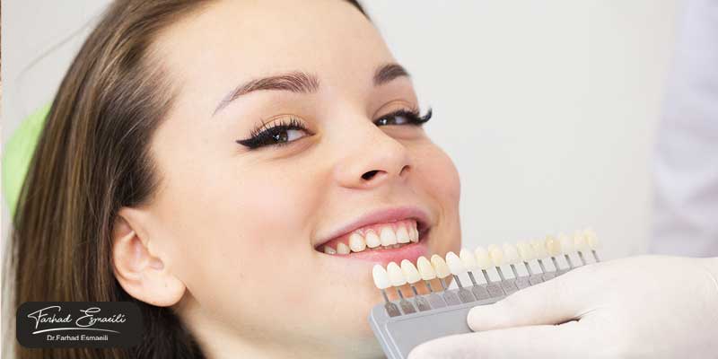 آیا لمینت دندان در صورت آسیب دیدگی و یا افتادن، قابل تعویض است؟