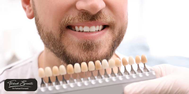 عوارض عدم رعایت بهداشت پس از لمینت