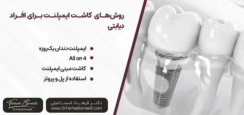 روشهای مختلف کاشت ایمپلنت برای افراد دیابتی