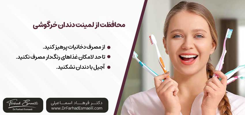 محافظت از لمینت دندان خرگوشی چگونه است؟